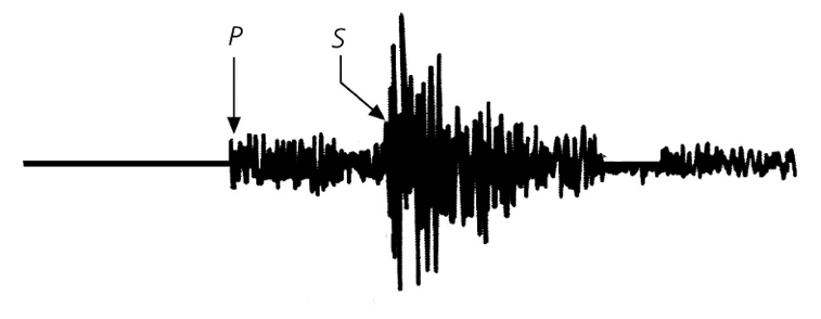 Metrix